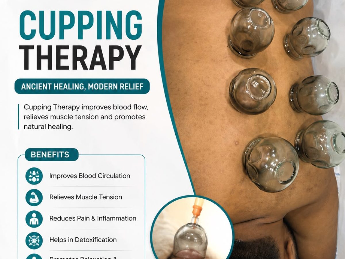 Cupping therapy